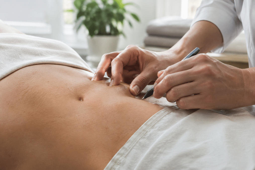 Cryolipolyse : avis, prix et résultats réels